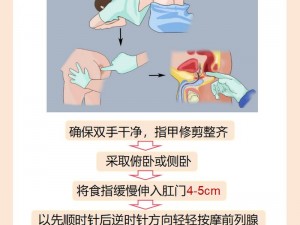 男性前列腺按摩GV、男性前列腺按摩 GV 是什么？